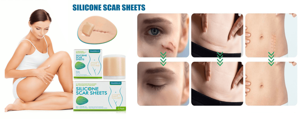 Silicone Scar Tape with Ergonomic Design: A Must-Have for Scar Care