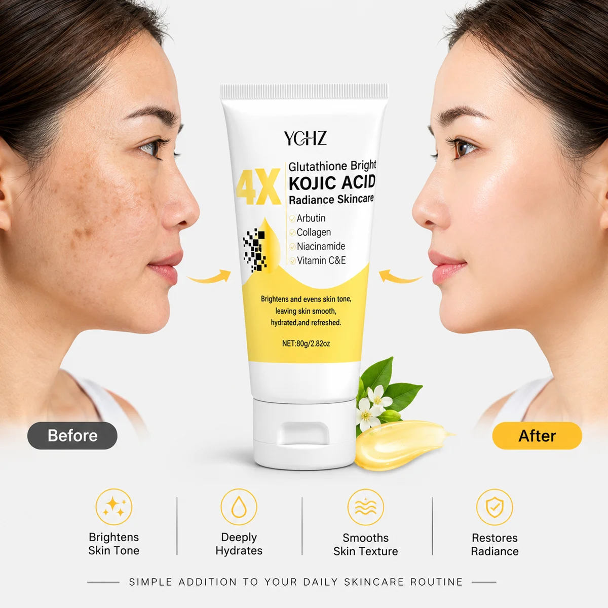 A woman's face shown before and after using YCHZ 4X Kojic Acid Radiance Skincare cream, highlighting smooth skin texture and brightened skin tone.